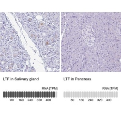 Lactoferrin Antibody, Novus Biologicals:Antibodies:Primary Antibodies
